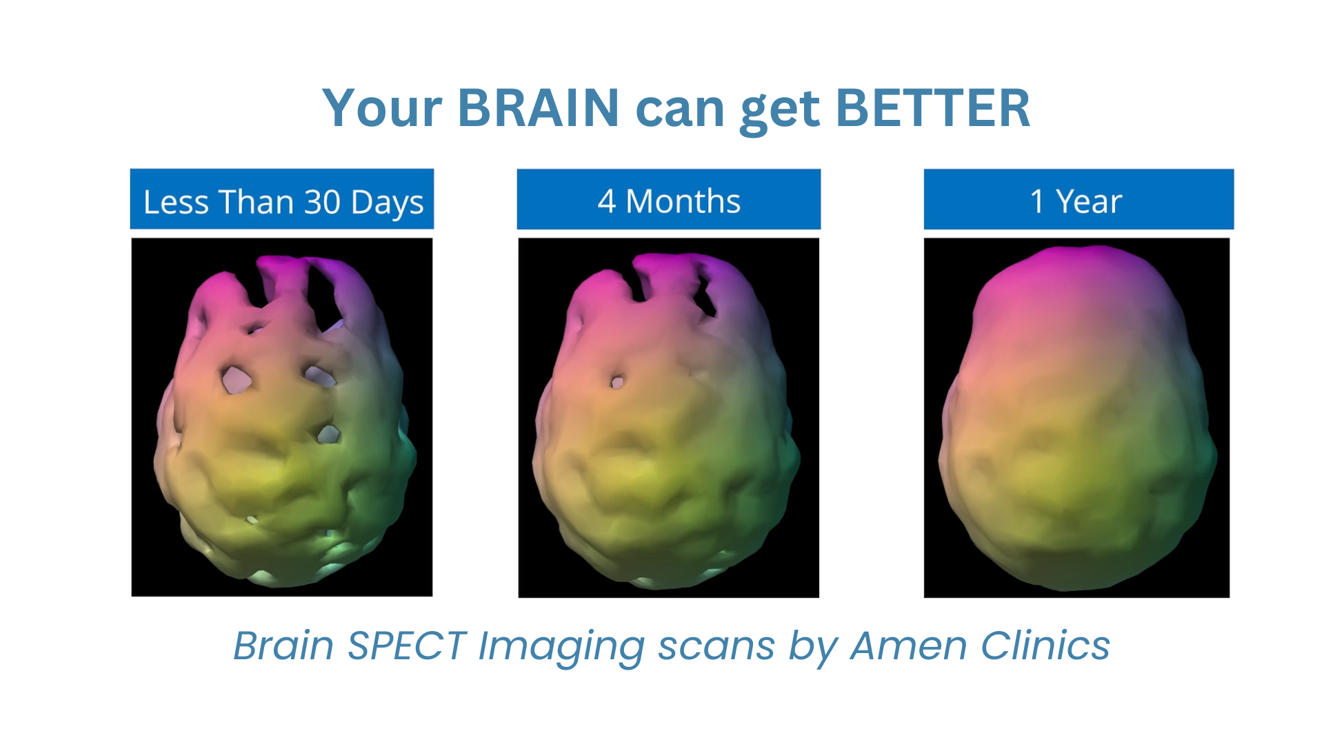 There are three brain SPECT imaging scans done by Amen Clinics, showing a brain can get better in less than 30 days, after 4 months, and then 1 year. 